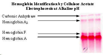 wpe1E.jpg (8775 bytes)